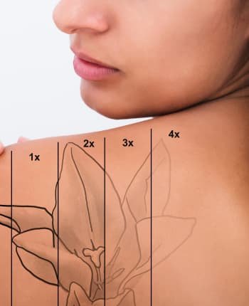 servicios de belleza en Toluca remocion de tatuajes sin dañar la piel