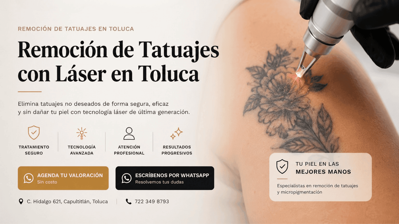 remocion de tatuajes en toluca